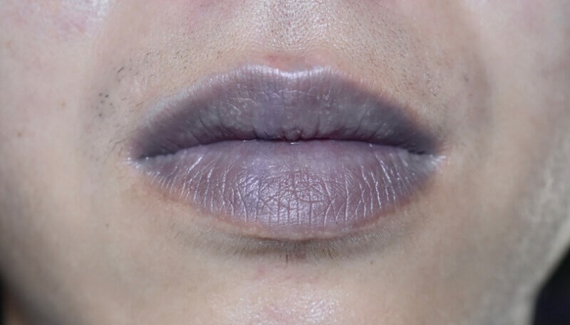 Lương y Trung Quốc Ngô Hoành Kiền cho biết thêm, quan sát màu môi cũng rất quan trọng trong việc phát hiện suy tim sớm.