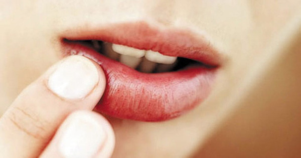 Nếu môi có màu tím bầm là tim bị ứ huyết, nên đến bệnh viện ngay để thăm khám trước khi bệnh tiến triển nặng hơn.