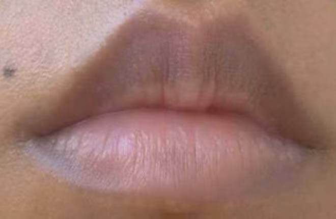 Khi môi có màu trắng có thể do thiếu máu hoặc huyết ứ. Trong trường hợp thiếu máu trầm trọng, thậm chí cả mặt, tai và móng tay sẽ chuyển sang màu trắng hoặc vàng nhạt, người dễ bị mất ngủ, tay chân lạnh.