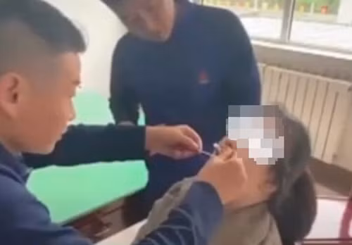 Giải cứu người phụ nữ bị vỏ ốc dính chặt vào môi khi ăn Giai cuu nguoi phu nu bi vo oc dinh chat vao moi khi an