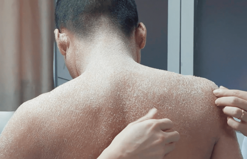 Cha me ket hon can huyet, con trai hoa “nguoi ran” dang so