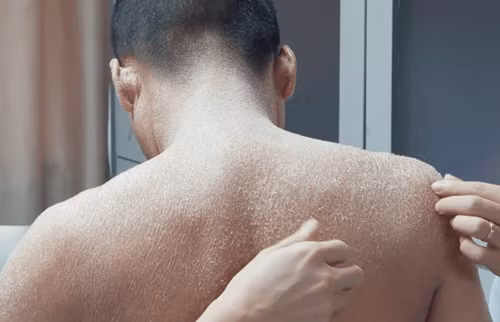 Cha mẹ kết hôn cận huyết, con trai hóa “người rắn” đáng sợ Cha me ket hon can huyet, con trai hoa “nguoi ran” dang so