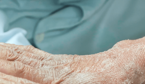 Cha me ket hon can huyet, con trai hoa “nguoi ran” dang so-Hinh-2