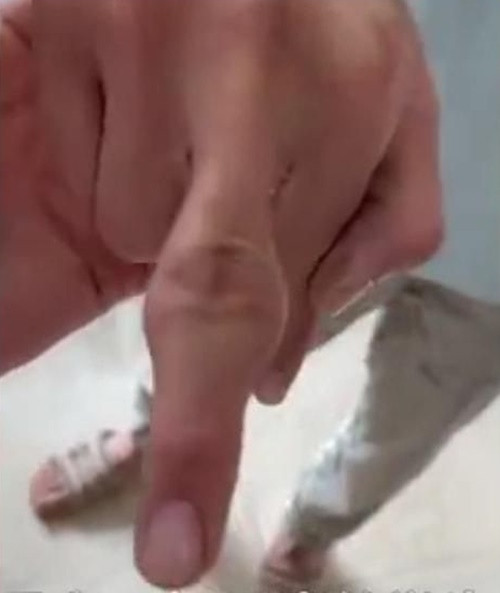 Uong tra sua qua nhieu, thieu nien bien dang ngon tay dang so