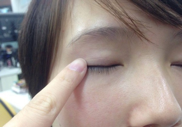 Mỗi khi mí mắt bị giật, nhiều người nghĩ không có gì nghiêm trọng, chỉ là có điềm báo gì đó, nhưng thực chất đây là trạng thái co cứng cơ. Bác sĩ chỉ ra 6 yếu tố có thể gây ra hiện tượng giật mí mắt, đáng sợ nhất là khối u chèn ép dây thần kinh mặt hoặc do tai biến mạch máu não. Nếu cảm thấy không ổn, hãy đến bệnh viện để điều trị ngay. (Ảnh minh họa)