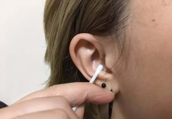Một số người thường xuyên dùng tăm bông để làm sạch tai, lấy ráy tai hoặc nước đọng. Tuy nhiên, các bác sĩ nhắc nhở rằng, lấy ráy tai thường xuyên không hề tốt như mọi người vẫn nghĩ. Ráy tai tốt hơn hết nên được đào thải ra ngoài theo cách tự nhiên. (Ảnh minh họa)