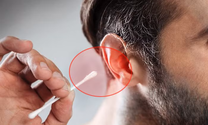 Ngoài ra, bác sĩ Nhan cũng chỉ ra, ráy tai có 3 chức năng kỳ diệu, giúp bảo vệ tai rất mạnh mẽ. Cụ thể, ráy tai là một chất nhờn có tính axit yếu, có chứa các enzym, thứ nhất có thể ức chế sự phát triển của vi khuẩn và nấm mốc, thứ hai có thể xua đuổi côn trùng.