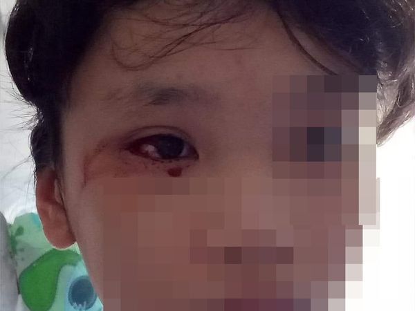 Hoc truc tuyen 8 tieng/ngay, be gai 12 tuoi chay mau mat o at