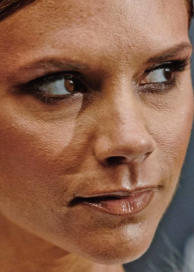 Cũng giống như nhiều bà mẹ bận rộn ở độ tuổi 30 khác, Victoria Beckham đôi khi phải đối phó với những làn da "phản chủ". Thường xuyên bay qua nhiều múi giờ, cộng với việc nuôi con và áp lực công việc, căng thể hiện rõ trên làn da. Thêm vào đó, những năm ở độ tuổi 30 là những năm đầu tiên xuất hiện mụn trứng cá do hooc-môn gây ra.