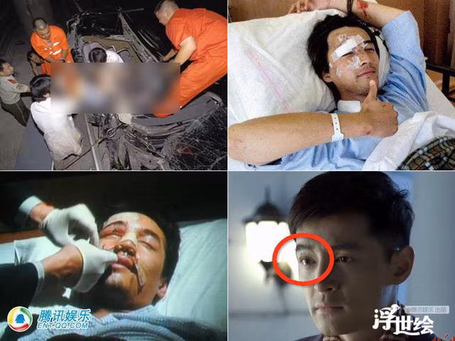 Nhung lan thoat luoi hai tu than ngoan muc cua sao Cbiz