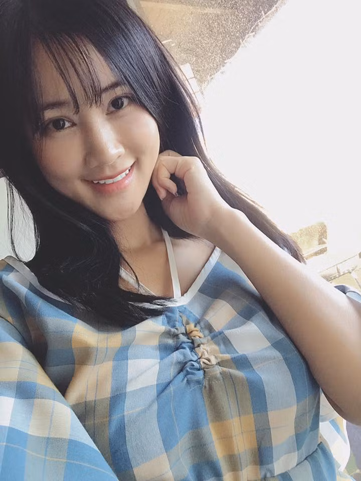 Cũng chính vì thẩm mỹ của Maya không xâm lấn nhiều nên khuôn mặt cô không bị sưng lâu. Theo nữ ca sĩ thì ở độ tuổi cô, lại là người làm trong showbiz, giờ mới đi phẫu thuật thẩm mỹ là muộn.