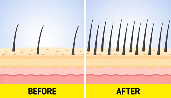 Phục hồi các nang tóc. Tích cực chà xát móng tay vào nhau, nó sẽ kích thích não bộ gửi tín hiệu tích cực, giúp phục hồi nang tóc hư tổn. Kiên trì áp dụng kết hợp thay đổi thói quen sinh hoạt, tóc sẽ nhanh chóng mọc lại sau 6-9 tháng.