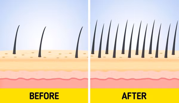 Phục hồi các nang tóc. Tích cực chà xát móng tay vào nhau, nó sẽ kích thích não bộ gửi tín hiệu tích cực, giúp phục hồi nang tóc hư tổn. Kiên trì áp dụng kết hợp thay đổi thói quen sinh hoạt, tóc sẽ nhanh chóng mọc lại sau 6-9 tháng.