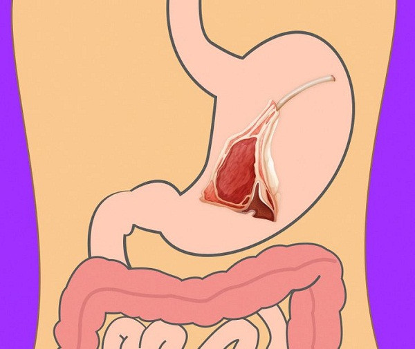 Dạ dày mất 4 giờ để tiêu hóa món ăn từ thịt cừu.
