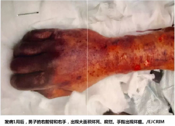 Bi cho liem, nguoi dan ong chet tuc tuoi trong dau don