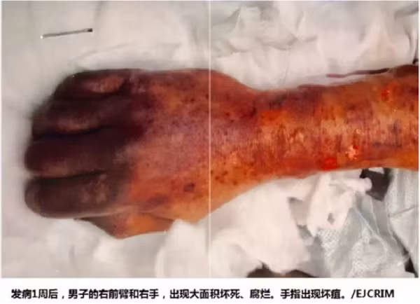 Bi cho liem, nguoi dan ong chet tuc tuoi trong dau don