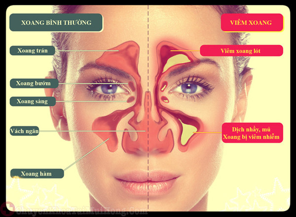 Bình thường vi sinh vật trong chất nhầy không gây bệnh. Chỉ có khi sức đề kháng của con người kém mới gây ốm đau. Trong khi đó thói quen ngoáy mũi tưởng giúp bạn thoải mái hơn lại gây hại khủng khiếp.