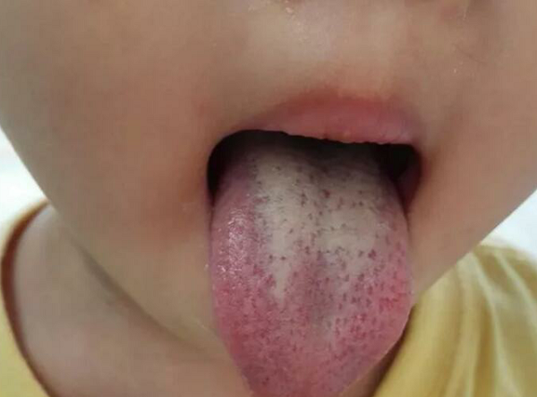 Nhoi nhet con an, cha me hoi han vi suyt day tre den cua tu-Hinh-2