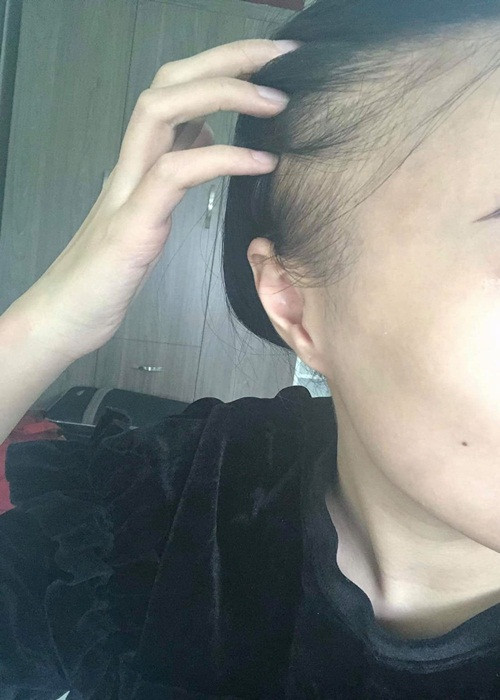 "Tác dụng phụ của hoá chất khiến cả cơ thể lẫn tinh thần tôi rã rời, kiệt quệ. Thậm chí đã có lúc quá mệt mỏi, tôi xin mẹ hãy cho tôi được giải thoát", Diễm My cho hay.