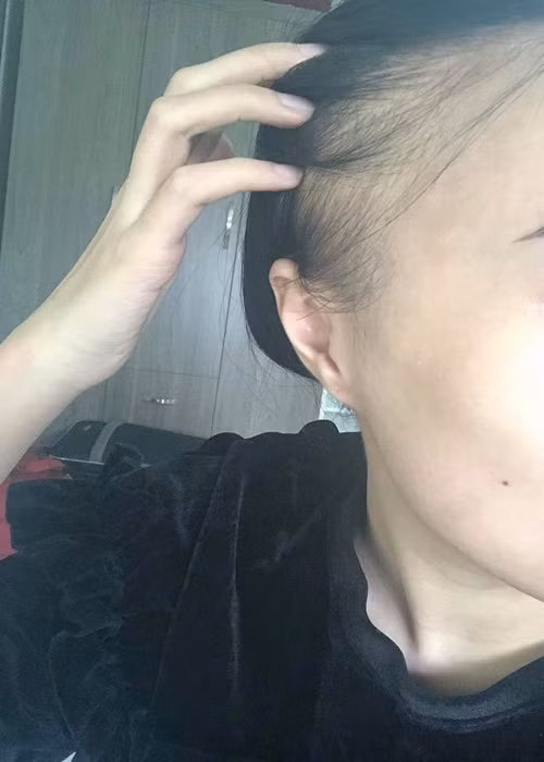 "Tác dụng phụ của hoá chất khiến cả cơ thể lẫn tinh thần tôi rã rời, kiệt quệ. Thậm chí đã có lúc quá mệt mỏi, tôi xin mẹ hãy cho tôi được giải thoát", Diễm My cho hay.