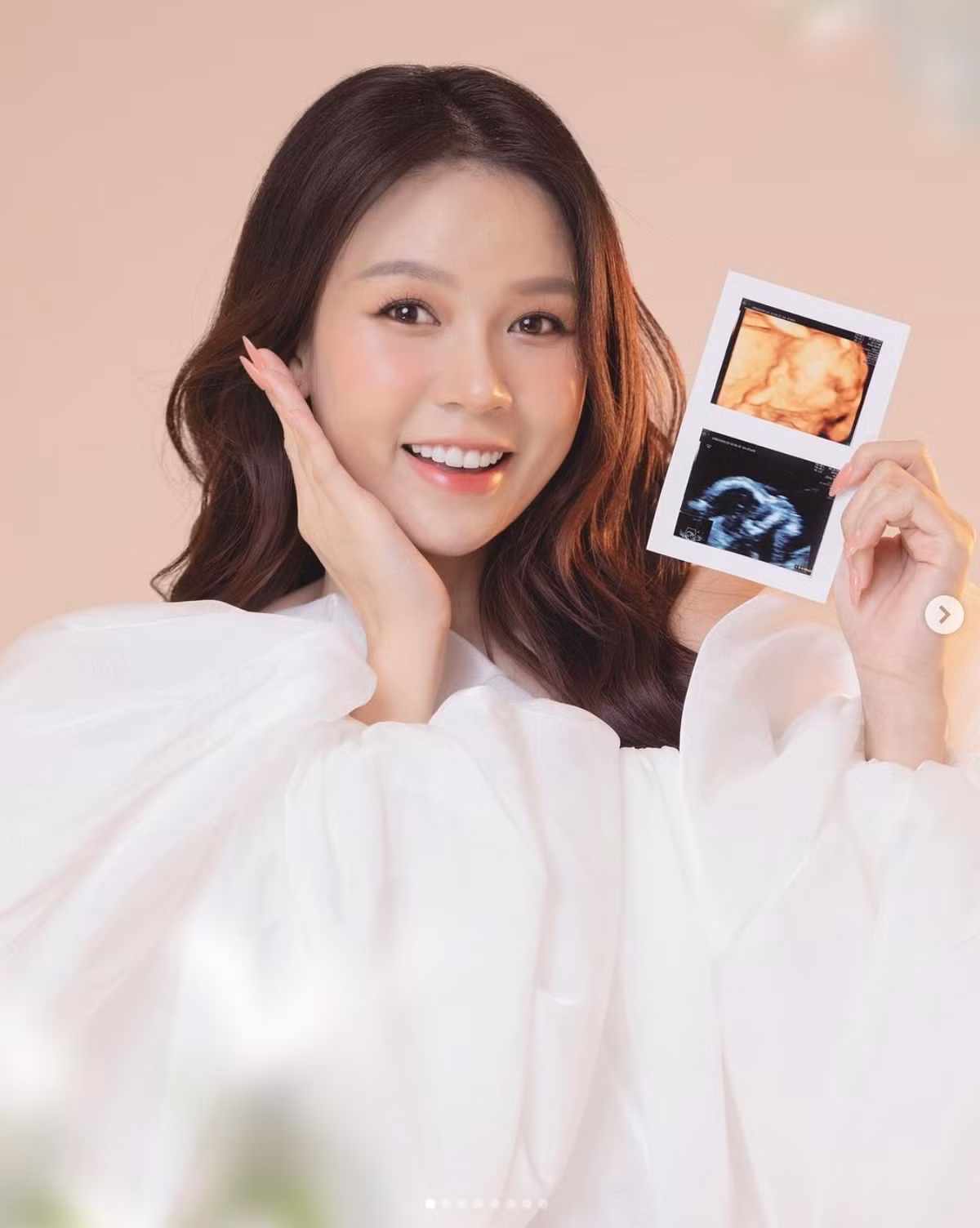 Vào ngày đặc biệt này, Sam xác nhận đã mang thai con đầu lòng. Cô khoe bức ảnh nhan sắc rạng rỡ kèm phiếu siêu âm để bày tỏ niềm hạnh phúc: "Sinh nhật năm nay có món quà quý giá nhất trên đời".