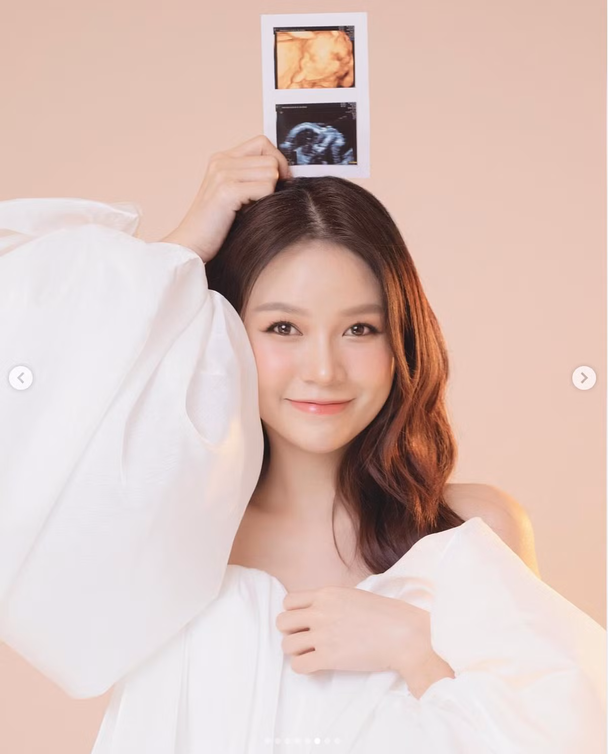 Dù diện váy rộng giấu dáng nhưng trong các bức ảnh chụp gần đây, Sam vẫn để lộ phần bụng nhô cao lấp ló.