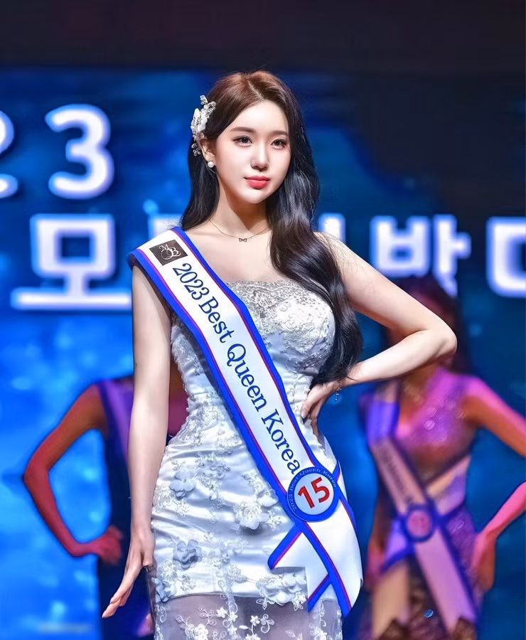 Kim Hyun Young có cả nhan sắc lẫn vóc dáng nổi bật, với chiều cao lên đến 1m70, nặng 50kg, sở hữu số đo 3 vòng lần lượt là: 92-61-97 (cm).