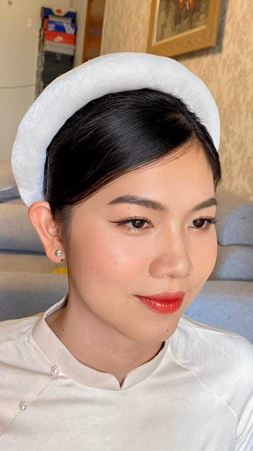 Ánh Viên của thì hiện tại đã khác rất nhiều so với trước. Thế nhưng, sự khác biệt này không đến từ việc cô đã "dao kéo" đường nét nào đó trên gương mặt.