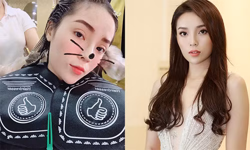 Ky Duyen lai vuong nghi van phau thuat tham my vi mat sung hup