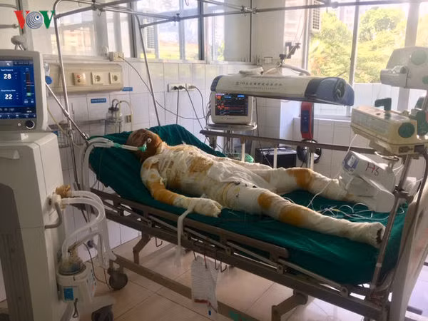 He lo nhan than ke khoa trai cua thieu song ca gia dinh nguoi tinh