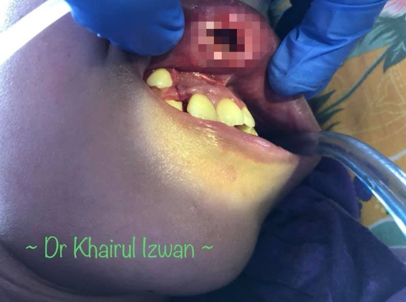 Kinh di ky sinh trung cuc so chui ruc trong moi nguoi dan ong