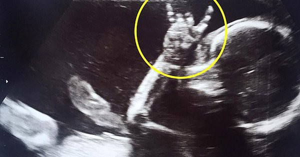 Di sieu am, em be gio tay lam dieu... ba me phat cuong