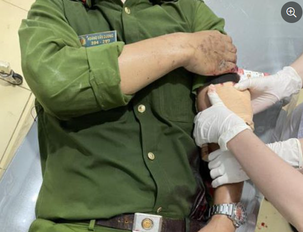  Dùng rựa rượt đuổi, chém gần đứt cánh tay một thượng úy: Ngày 15/7, khi lực lượng chức năng đến nhà vận động Nguyễn Quốc Bảo (31 tuổi, trú xã Hòa Hiệp, huyện Xuyên Mộc, Bà Rịa - Vũng Tàu) chấp hành làm việc nhưng đối tượng cố thủ bên trong rồi dùng rựa chém Thượng úy Hoàng Văn Dương, Công an xã Thắng Hải trọng thương. 