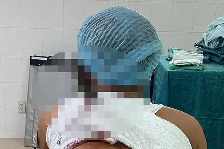 Vác dao chém đối tác chung tiền kinh doanh game bắn cá: Mâu thuẫn khi góp vốn kinh doanh game bắn cá, Hoàng Trần Nga (SN 1990, TP Gia Nghĩa, Đắk Nông) dùng dao chém chị D.T (SN 1980) gây thương tích 48%. Ngày 14/7, Nga bị truy tố tội "Cố ý gây thương tích". 