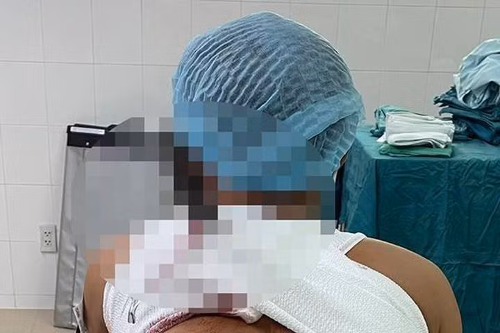 Vác dao chém đối tác chung tiền kinh doanh game bắn cá: Mâu thuẫn khi góp vốn kinh doanh game bắn cá, Hoàng Trần Nga (SN 1990, TP Gia Nghĩa, Đắk Nông) dùng dao chém chị D.T (SN 1980) gây thương tích 48%. Ngày 14/7, Nga bị truy tố tội "Cố ý gây thương tích". 