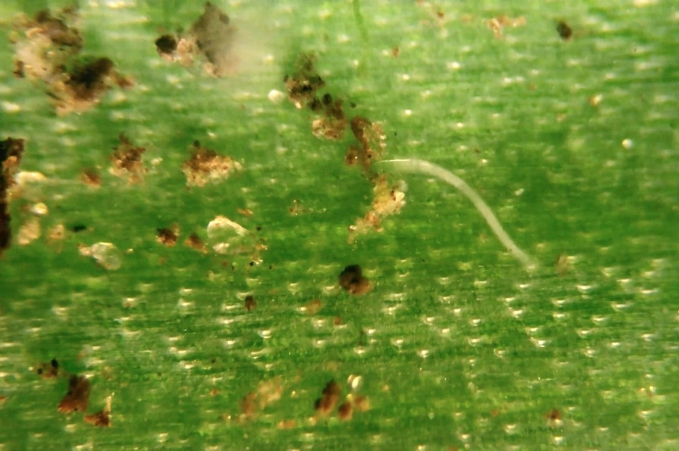 Mới đây, một sinh viên người Đan Mạch đã sử dụng kính hiển vi để chứng minh, tất cả loại rau sạch đều bẩn ngoài sức tưởng tượng của con người.