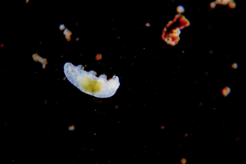 Cụ thể, Martin đã tới siêu thị và mua một số loại rau tươi sạch và kiểm tra bề mặt của những loại rau này bằng kính hiển vi.