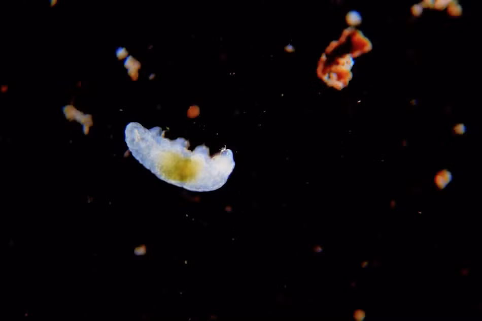 Cụ thể, Martin đã tới siêu thị và mua một số loại rau tươi sạch và kiểm tra bề mặt của những loại rau này bằng kính hiển vi.