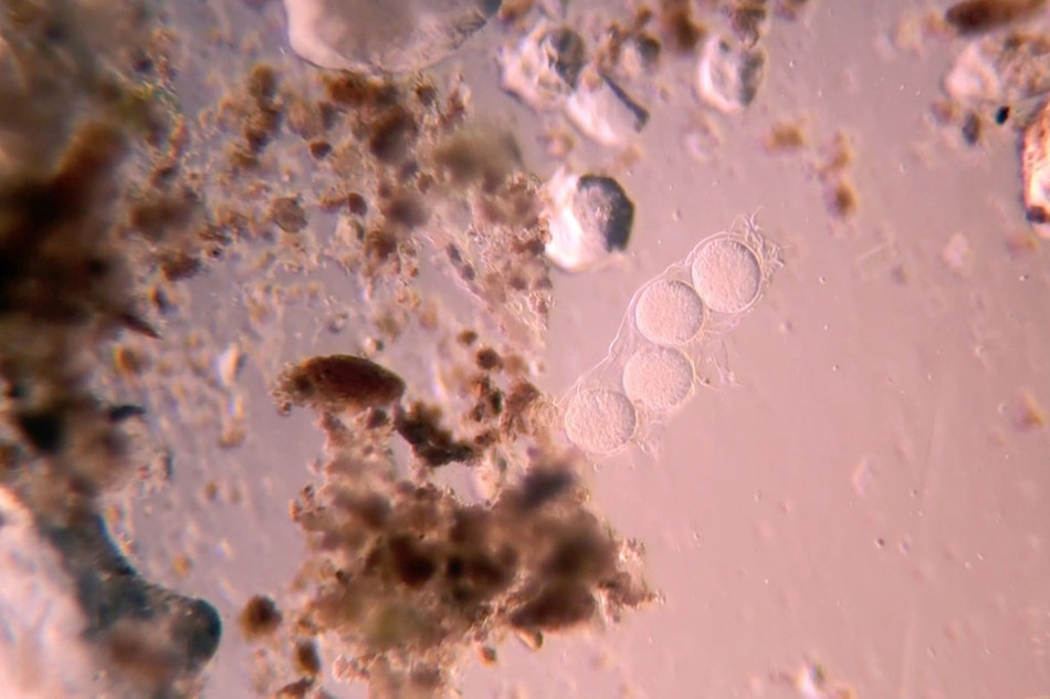 Sau khi xem những hình ảnh mà Martin Kaae Kristiansen chụp được, nhiều người không khỏi rợn người và từ bỏ thói quen ăn rau sống của mình.