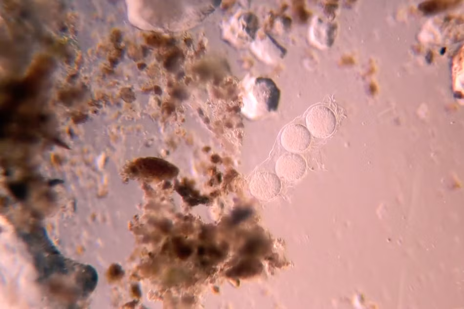 Sau khi xem những hình ảnh mà Martin Kaae Kristiansen chụp được, nhiều người không khỏi rợn người và từ bỏ thói quen ăn rau sống của mình.