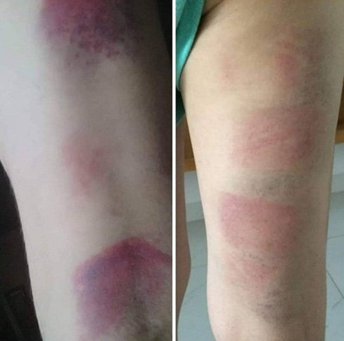 Bo GD&DT noi gi vu co giao bi to danh bam tim chan 22 hoc sinh?