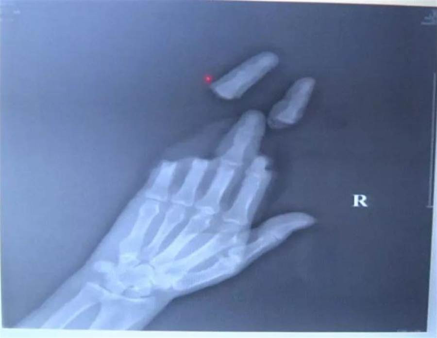 Tha dieu ngay gio lon, nguoi dan ong gap chuyen kho tin