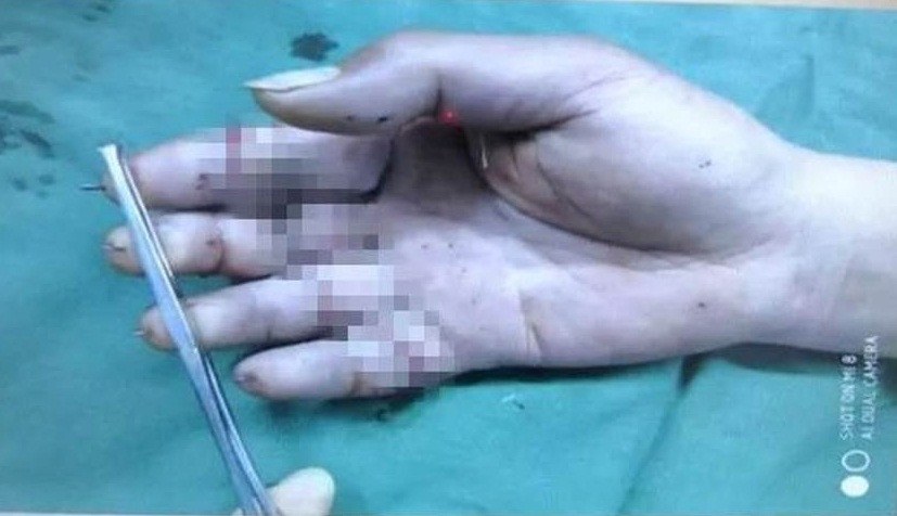 Tha dieu ngay gio lon, nguoi dan ong gap chuyen kho tin-Hinh-2