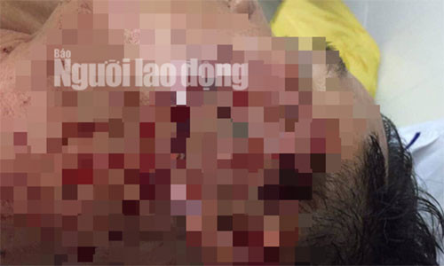 Nghi van chau lanh dao huyen danh trong thuong dai uy cong an thi tran