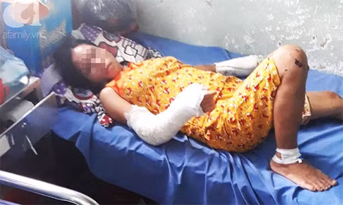 Vụ chồng đánh vợ đang mang bầu ở Bình Thuận gây bức xúc dư luận.