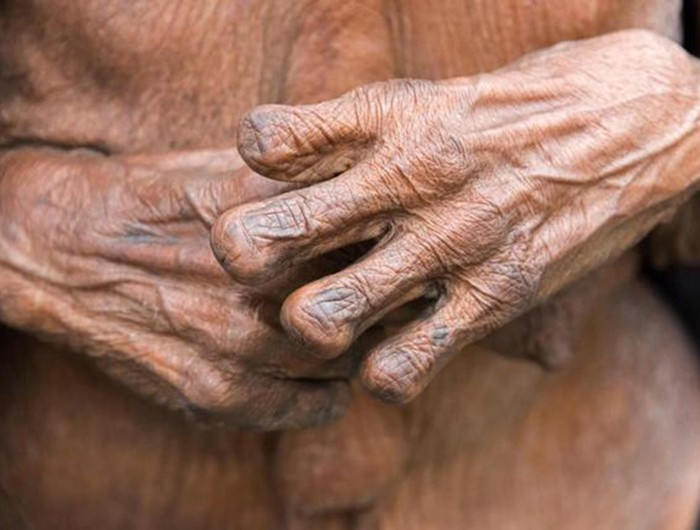 Họ cho rằng, việc cắt đầu ngón tay sẽ khiến cho linh hồn của người quá cố được ra đi thanh thản, theo đó, các em bé cũng bị người mẹ cắt đầu ngón tay.