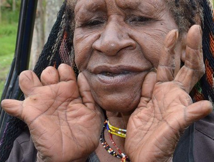 Nghi thức này đã bị chính phủ Indonesia cấm cách đây vài năm do phương thức tiến hành quá đáng sợ và bạo lực, tuy nhiên nhiều người phụ nữ vẫn bí mật thực hiện hủ tục này.