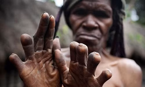 Việc sống tách biệt khỏi xã hội văn minh đã tạo điều kiện để những tộc người này có cơ hội lưu truyền các phong tục được coi là "khác người" vì sự kỳ lạ của nó. Bộ lạc Dani - Indonesia ngày nay vẫn lưu giữ nghi thức kỳ lạIkipalin - phong tục truyền thống cắt phần đầu ngón tay để xua đuổi tà ma khi người thân mất.