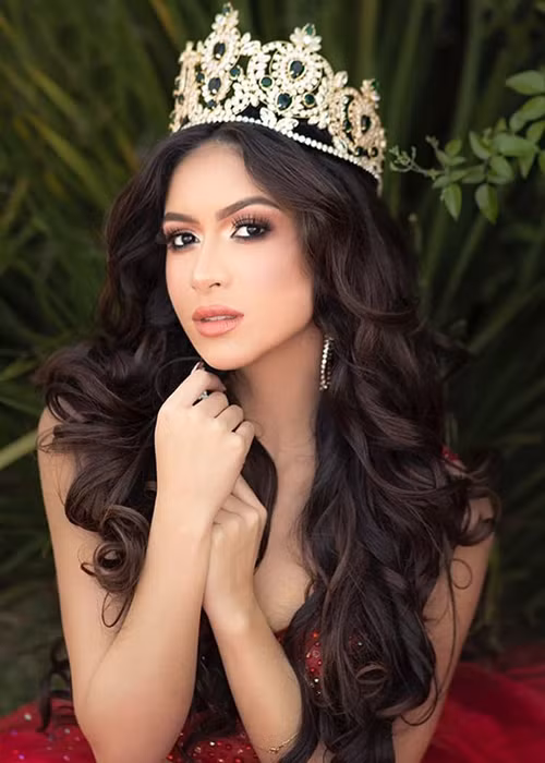 Milena năm nay 23 tuổi, là sinh viên năm thứ 3 ngành Luật và Quan hệ quốc tế. Cô cao 1m72, là vũ công.