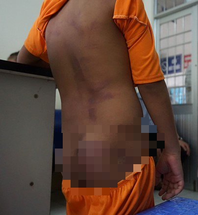 Cong an vao cuoc vu 4 anh chi em nghi bi ong noi bao hanh